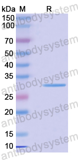 Recombinant Human COQ10B Protein, N-His-SUMO