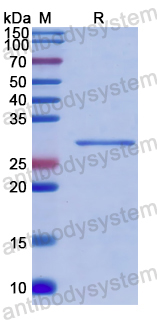 Recombinant Human PAOX Protein, N-His