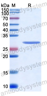 Recombinant Human EIF3M Protein, N-His
