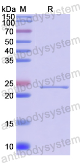 Recombinant Human CIB3 Protein, N-His
