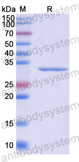 Recombinant Human XYLT2 Protein, N-His