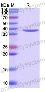 Recombinant Human PLCZ1 Protein, N-GST