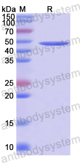 Recombinant Human ADAM29 Protein, N-His