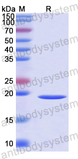 Recombinant Human TMX2 Protein, N-His