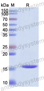 Recombinant Human EMC6/TMEM93 Protein, N-His-SUMO