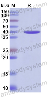 Recombinant Human ADAM19 Protein, N-His