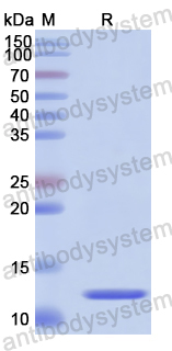 Recombinant Human SLCO1B1/LST-1/OATP-2 Protein, N-His