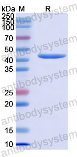 Recombinant Human NEDD4L/Nedd4-2 Protein, N-His