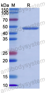 Recombinant Human EML4-ALK Protein, N-His