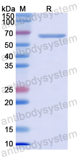 Recombinant Human EML4/EMAP-4/Ropp 120 Protein, N-His