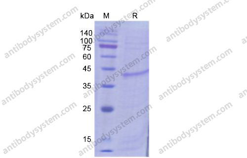 Recombinant Human Dermokine-gamma 1 Protein, 2/DMKN Protein, N-His