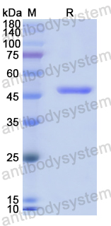 Recombinant Human Dermokine beta/DMKN Protein, N-His