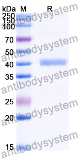 Recombinant Human DOCK5 Protein, N-GST