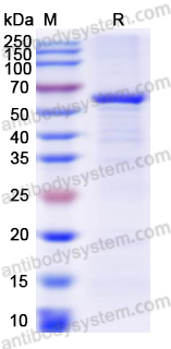 Recombinant Human NEU3/Sialidase-3 Protein, C-His