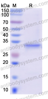 Recombinant Human SLC39A4/ZIP4 Protein, N-His