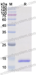 Recombinant Human TRDV1/TCR VD 1 Protein, C-His