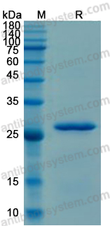 Recombinant Human BCR/ABL Protein, N-His-SUMO