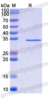 Recombinant Human PBK Protein, N-His