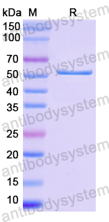 Recombinant Human SMYD2 Protein, N-His