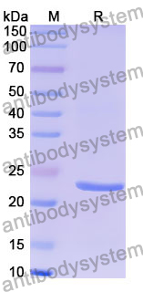 Recombinant Human TDRKH Protein, N-His