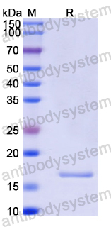 Recombinant Human NSD3/WHSC1L1 Protein, N-His