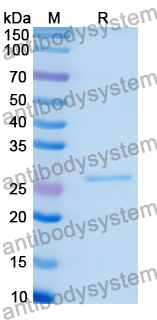 Recombinant Human KNL1 Protein, N-His