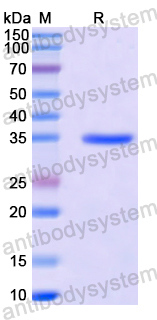 Recombinant Human SLC5A8 Protein, N-GST & C-His