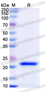 Recombinant Human RPP25 Protein, N-His