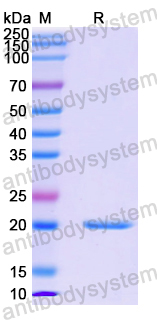 Recombinant Human ADAT3 Protein, N-His