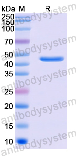 Recombinant Human TMPRSS11E/DESC1 Protein, N-His
