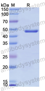 Recombinant Human STAMBPL1/AMSHLP Protein, N-GST & C-His