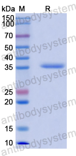 Recombinant Human GBP5 Protein, N-His