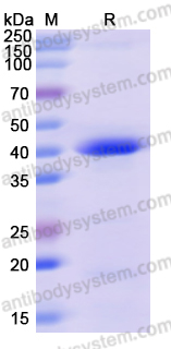 Recombinant Human DNAJB11 Protein, N-His