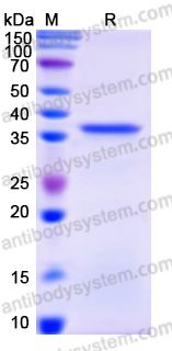 Recombinant Human TUBGCP3 Protein, N-His