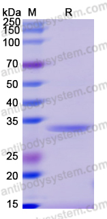 Recombinant Human DNAJB14 Protein, N-His-SUMO