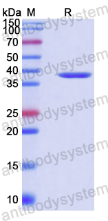 Recombinant Human FZR1 Protein, N-His