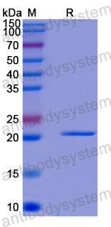 Recombinant Human DNAI2 Protein, N-His-SUMO