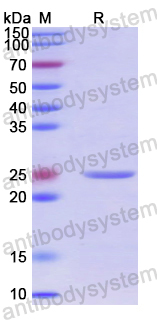 Recombinant Human DNAJB9 Protein, N-His