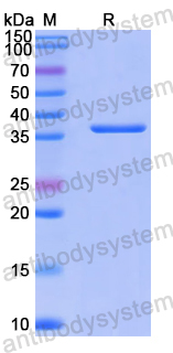 Recombinant Human DNAAF4 Protein, N-GST & C-His