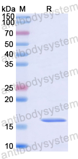 Recombinant Human VIRMA Protein, N-His
