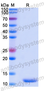 Recombinant Human SFI1 Protein, N-His