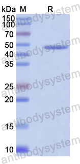 Recombinant Human UNC45A Protein, N-His