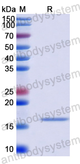 Recombinant Human WBP2 Protein, N-His