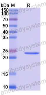 Recombinant Human ADI1 Protein, N-His