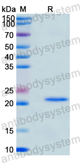 Recombinant Human RBM15B Protein, N-His
