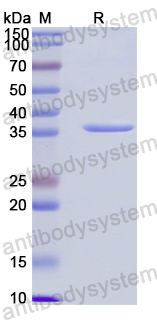 Recombinant Human POLDIP2 Protein, N-His
