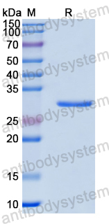 Recombinant Human RABGEF1 Protein, N-His