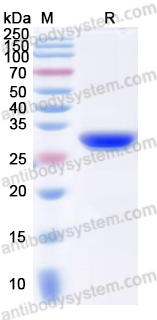 Recombinant Human RAI14 Protein, N-His