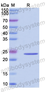Recombinant Human SFXN1 Protein, N-His-SUMO