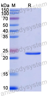 Recombinant Human TCF7L1 Protein, N-His-SUMO